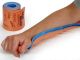 Sam splint/ Flexall splint